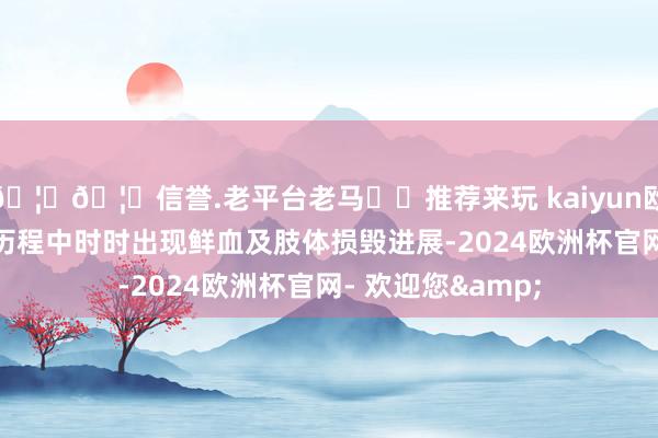 🦄🦄信誉.老平台老马✔️推荐来玩 kaiyun欧洲杯app在搏斗历程中时时出现鲜血及肢体损毁进展-2024欧洲杯官网- 欢迎您&